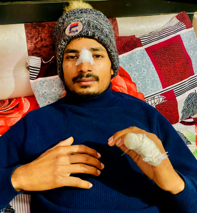 Read more about the article ਗੜ੍ਹਦੀਵਾਲਾ : ਚਾਈਨਾ ਡੋਰ ਦੀ ਚਪੇਟ ਆਉਣ ਨਾਲ ਮੋਟਰਸਾਇਕਲ ਨੌਜਵਾਨ ਦੀ ਉਂਗਲੀ ਕੱਟੀ 