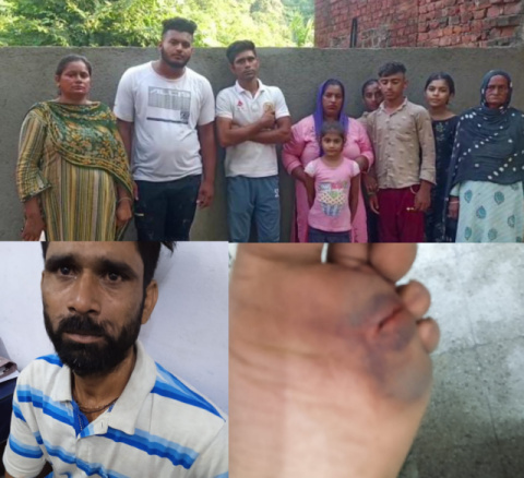 You are currently viewing भदरोया की महिला ने उसी के गांव के कुछ लोगों पर उनके परिवार के साथ मारपीट करने के लगाए आरोप