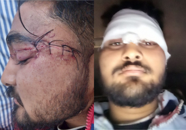 You are currently viewing ਪਿਓ ਪੁੱਤ ਚਾਇਨਾ ਡੋਰ ਦੀ ਲਪੇਟ ‘ਚ ਆਏ,ਪੁੱਤ ਗੰਭੀਰ ਜਖਮੀ,ਪਿਓ ਬਾਲ ਬਾਲ ਬਚਿਆ 