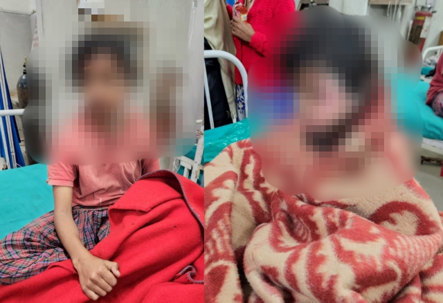 You are currently viewing ਕਲਯੁਗੀ ਪਿਉ ਨੇ ਆਪਣੀਆਂ ਨਬਾਲਿਗ ਧੀਆਂ ਨੂੰ ਅੱਗ ਲਗਾ ਕੇ ਸਾੜਿਆ,ਦੋਵੇਂ ਧੀਆਂ ਪੀਜੀਆਈ ਵਿਖੇ ਜੇਰੇ ਇਲਾਜ