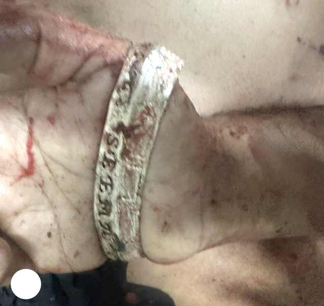 You are currently viewing ਜਲੰਧਰ ਪਠਾਨਕੋਟ ਨੈਸ਼ਨਲ ਹਾਈਵੇ ਤੇ ਨੌਜਵਾਨ ਦੀ ਭੇਦਭਰੇ ਹਾਲਾਂਤਾਂ ‘ਚ ਮਿਲੀ ਲਾ+ਸ਼,ਚਿਹਰਾ ਪਹਿਚਾਨਣ ਯੋਗ ਨਹੀਂ