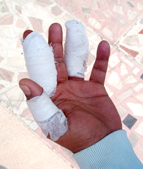 You are currently viewing ਚਾਇਨਾ ਡੋਰ ਨਾਲ ਪਿਓ ਹੋਇਆ ਗੰਭੀਰ ਜਖਮੀ, ਬੇਟੀ ਬਾਲ ਬਾਲ ਬਚੀ 