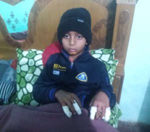 Read more about the article ਚਾਈਨਾ ਡੋਰ ਦੀ ਲਪੇਟ ਚ ਆਉਣ ਨਾਲ ਸੱਤ ਸਾਲਾਂ ਨਵਦੀਪ ਸਿੰਘ ਗੰਭੀਰ ਜਖਮੀ