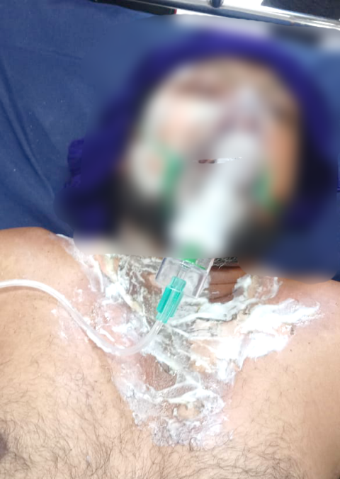 You are currently viewing ਫਿਊਜ ਲਗਾਉਣ ਲਈ ਖੰਬੇ ਤੇ ਚੜੇ ਮੁਲਾਜਮ ਨੂੰ ਲੱਗਾ ਕਰੰਟ, ਗੰਭੀਰ ਜਖਮੀ