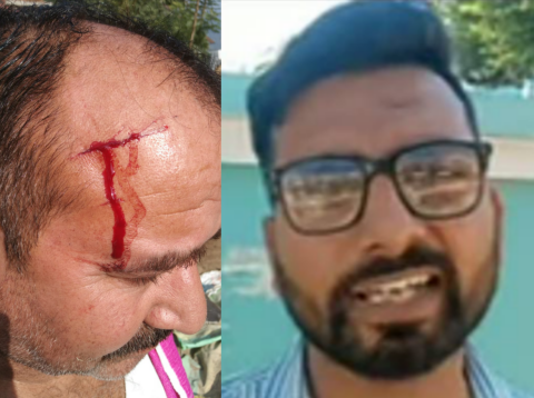 You are currently viewing बकरियां चराने गए व्यक्ति पर बाघ ने हमला कर किया घायल..!