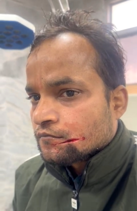 You are currently viewing ਚਾਇਨਾ ਡੋਰ ਨਾਲ ਨੌਜਵਾਨ ਹੋਇਆ ਗੰਭੀਰ ਜਖਮੀ.. ਵੀਡਿਓ ਹੋਈ ਵਾਇਰਲ