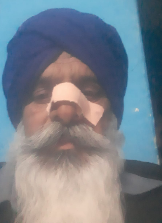 You are currently viewing खूनी चाइना डोर का कहर जारी,फिर एक बुजुर्ग हुआ जख्मी