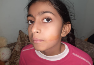 Read more about the article ਆਪਣੇ ਘਰ ਦੀ ਛੱਤ ਤੇ ਖੇਡ ਰਹੀ ਬੱਚੀ ਚਾਇਨਾ ਡੋਰ ਦੀ ਲਪੇਟ ਚ ਆਈ, ਜਖਮੀ