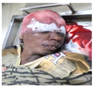 Read more about the article ਨਾਮਲੂਮ ਵਿਅਕਤੀ ਦਾ ਬੱਸ ਸਟੈਂਡ ਦਸੂਹਾ ਪੁੱਲ ਹੇਠਾਂ ਹੋਇਆ ਐਕਸੀਡੈਂਟ,ਲਾਸ਼ ਦੀ ਪਹਿਚਾਣ..